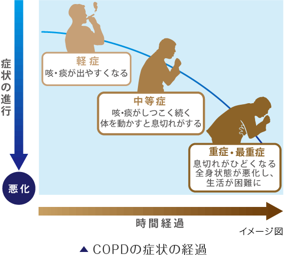 COPDの症状の経過