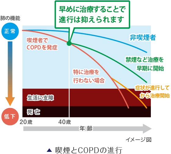 喫煙とCOPDの進行