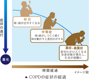 COPDの症状の経過