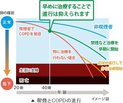喫煙とCOPDの進行